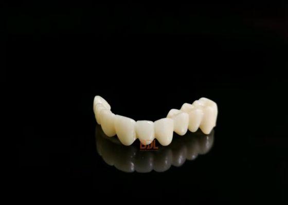 Long lasting ceramic dental prosthetics showing strength and aesthetic appeal