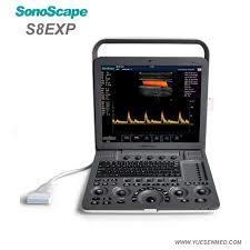 China Anti Glare Screen 2D Portable SonoScape Ultrasound Machine S8 Exp for sale
