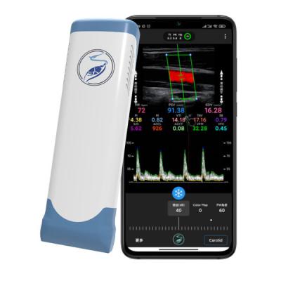 China 12MHz Wireless Iphone Ultrasound Scanners Electronic Linear Array for sale