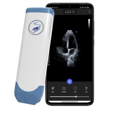 China 5MHz Pocket Handheld Ultrasound Scanner For Mobile Cardiac Diagnosis for sale