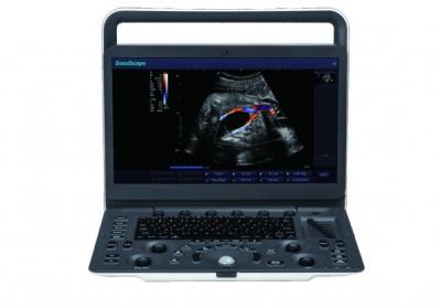 China 7 Imaging Levels SonoScape E3 Portable Ultrasound Machine With 15.6 Inch Monitor for sale
