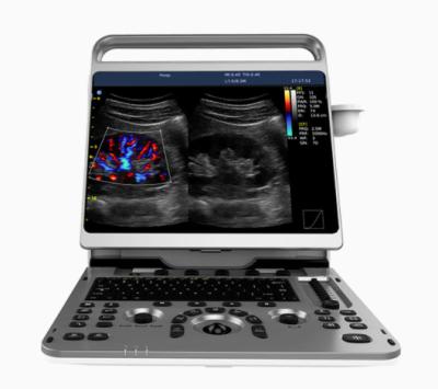China Portable Cardiac Ultrasound Machine Chison EBit 50 16.5lbs for sale