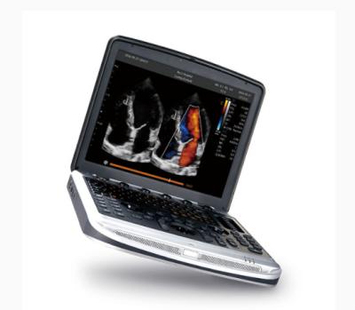 China FDA Approved Laptop Ultrasound Machine Chison SonoBook 8 For Echocardiography for sale