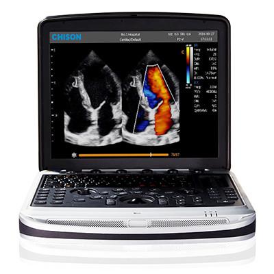 China Easy To Carry 4D Chison SonoBook 9 Laptop Ultrasound Machine for sale