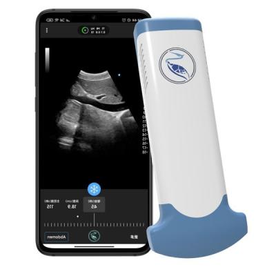 China Emergency Medicine MPEG-4 Handheld Ultrasound Scanner For Clinical Diagnostic Use for sale