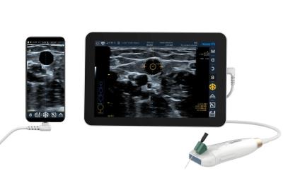 Chine scanner tenu dans la main portatif de l'ultrason 330g pour diagnostiquer la maladie périphérique d'artère à vendre