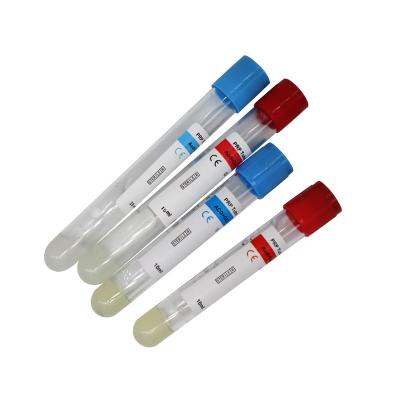 China PRP Tube 10ml 15ml 13ml With ACD Gel PRP PRF Tube for sale