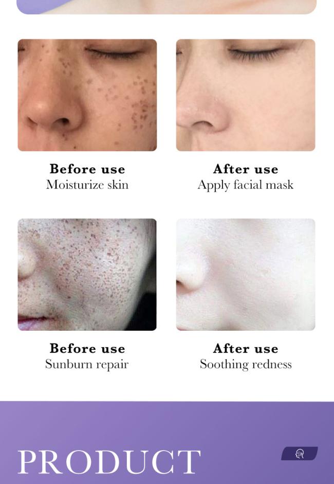 30ml Essence Face Serum 100% Pure Redness Radiant Skin Advanced Rosacea 1