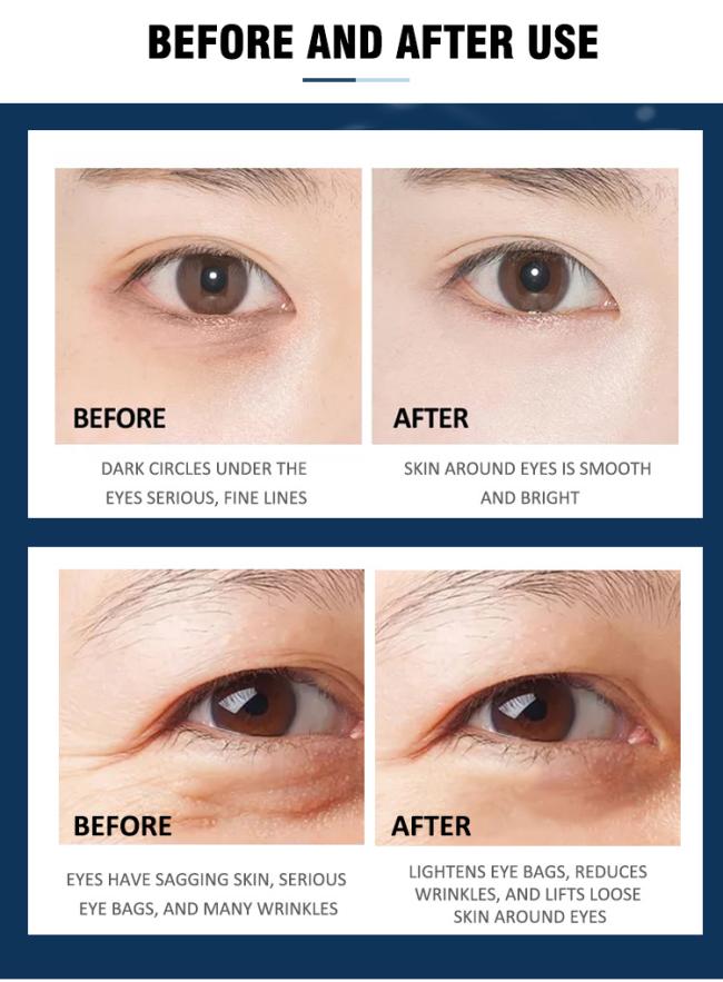 eyecream