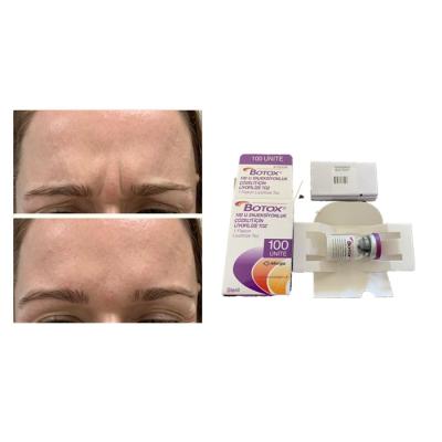 China White Allergan Botulinum Toxin Anti Aging Botox Injection for sale