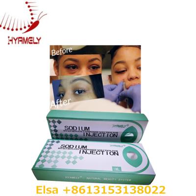 China 1 Ml Sodium Hyaluronate Gel Anti Dark Circles Dermal Filler For Eyes for sale