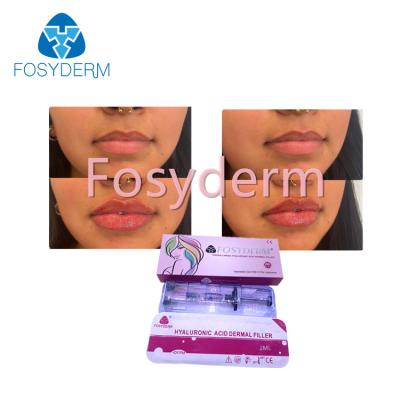 China El llenador cutáneo ácido hialurónico de Fosyderm de la inyección para la cruz del labio 2ml ligó en venta