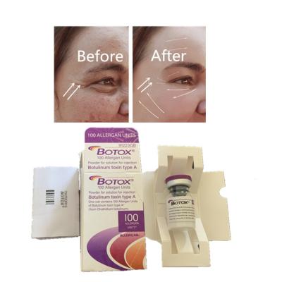China Wrinkle Reduction 100 Units Allergan Botox Injection Eliminates Facial Fine Lines for sale