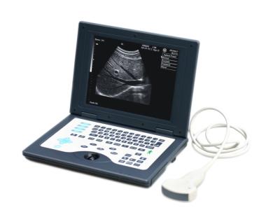 China High-End Laptop-Design B/W Ultrasound Imaging System CLS-5800 With Clear Images for sale