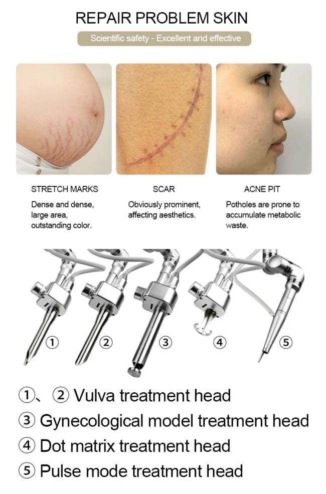 Portable Laser Co2 Fractional / Co2 Fractional Laser / Fractional Co2 Laser Machine For Skin Rejuvenation Machine Laser Co2