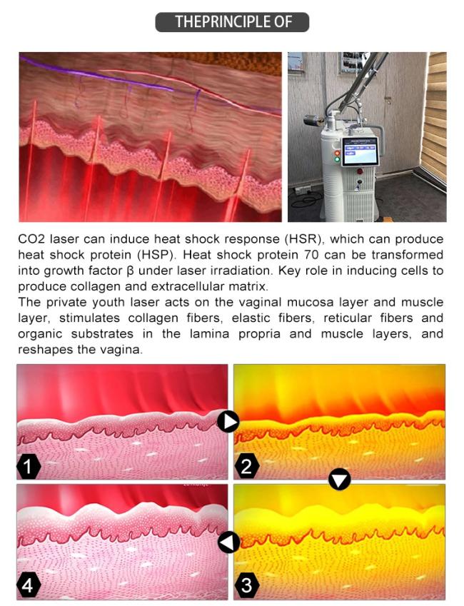 Portable Laser Co2 Fractional / Co2 Fractional Laser / Fractional Co2 Laser Machine For Skin Rejuvenation Machine Laser Co2