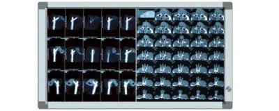 China LED X-ray viewer+STT-4000 for sale