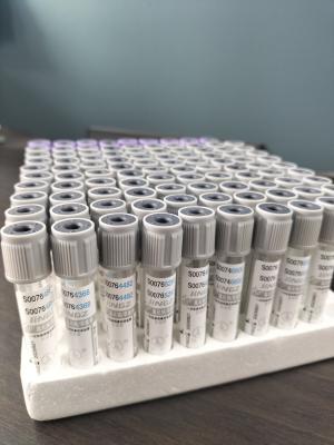 China Tubo de Glucose de Garrafa Cinza 2 ml-10 ml para coleta médica de sangue Tubo de vácuo à venda