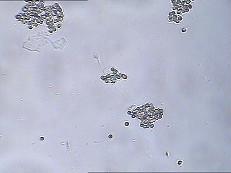 China MAR IgA Test Kit IgA Antibody Coating Spermatozoa MAR Sperm Function Test Kit for sale