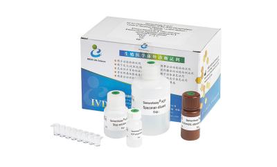 China Jogo masculino do teste da fertilidade BRED-007 para o nível ácido da fosfatase da determinação no plasma seminal à venda