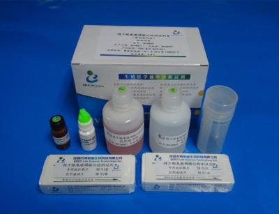 China Fosforilación de Kit For Determinate Protein Tyrosine en venta