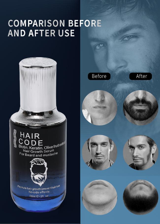 Anti Hair Loss Serum Hair Regrowth Hair Growth Essential Oil Biotin Olive Fruit Extract OEM Customized Private Label Factory Wholesale