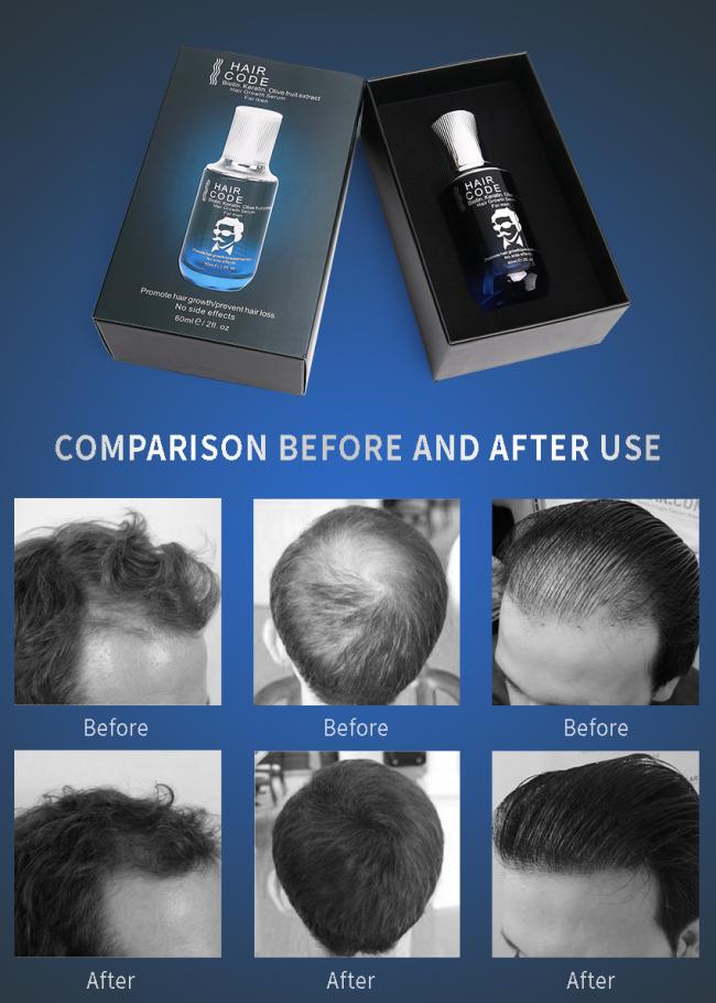 Hair Growth Serum Hair Code Anti Hair Loss Meso Essential Oil Biotin Olive Fruit Extract OEM Customized Private Label Factory Wholesale