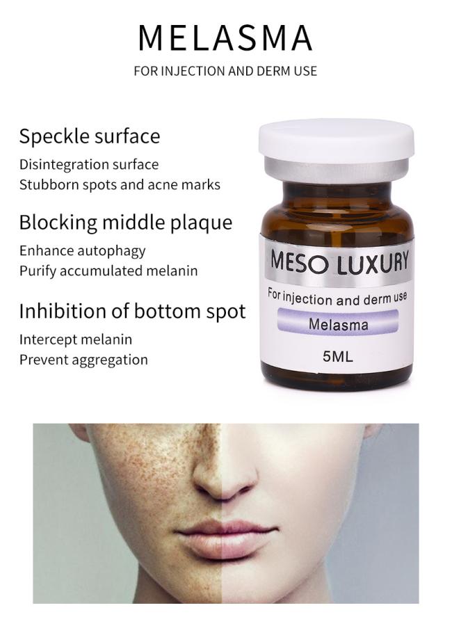 Acne Removal Mesotherapy Serum 5ml Acne Scar Removal Treatment Smooth Damaged Skin Whitening Moisturizing Face Injection Serum