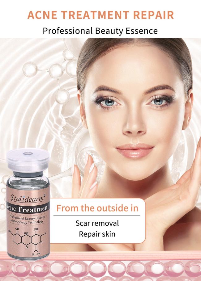 Private Label Stalidearm Hair Growth Product Scalp Essential Serum Regrowth Hair Loss Treatment