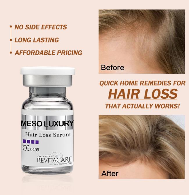 Factory Wholesale Price Professional OEM ODM Anti Hair Loss Products Hair Growth Essence Hair Regeneration Treatment Solutions 10ml