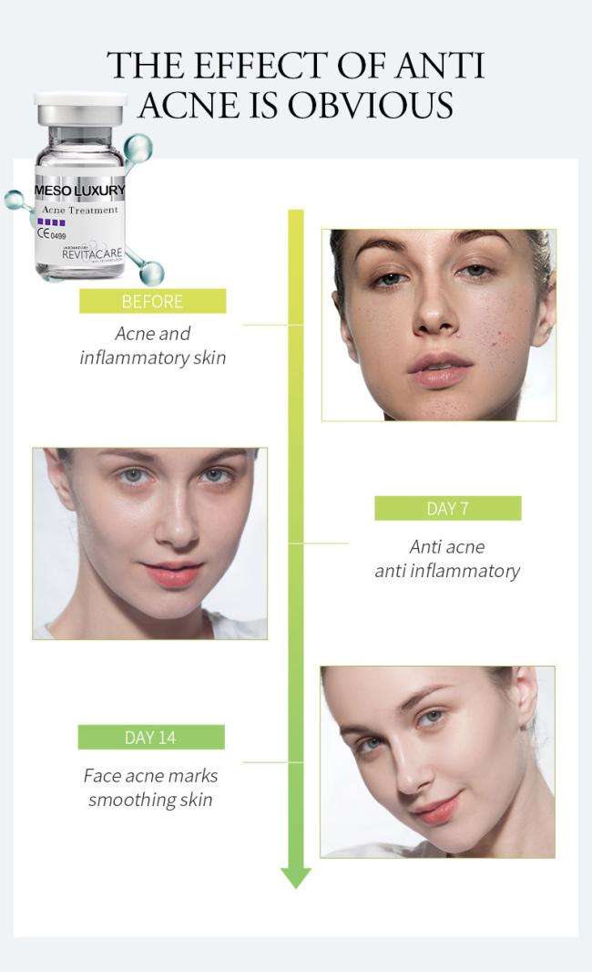 OEM/ODM Brand Omega-3 Essence Deep Moisturizing Anti Aging Facial Serum Firming Lifting Skin 10ml