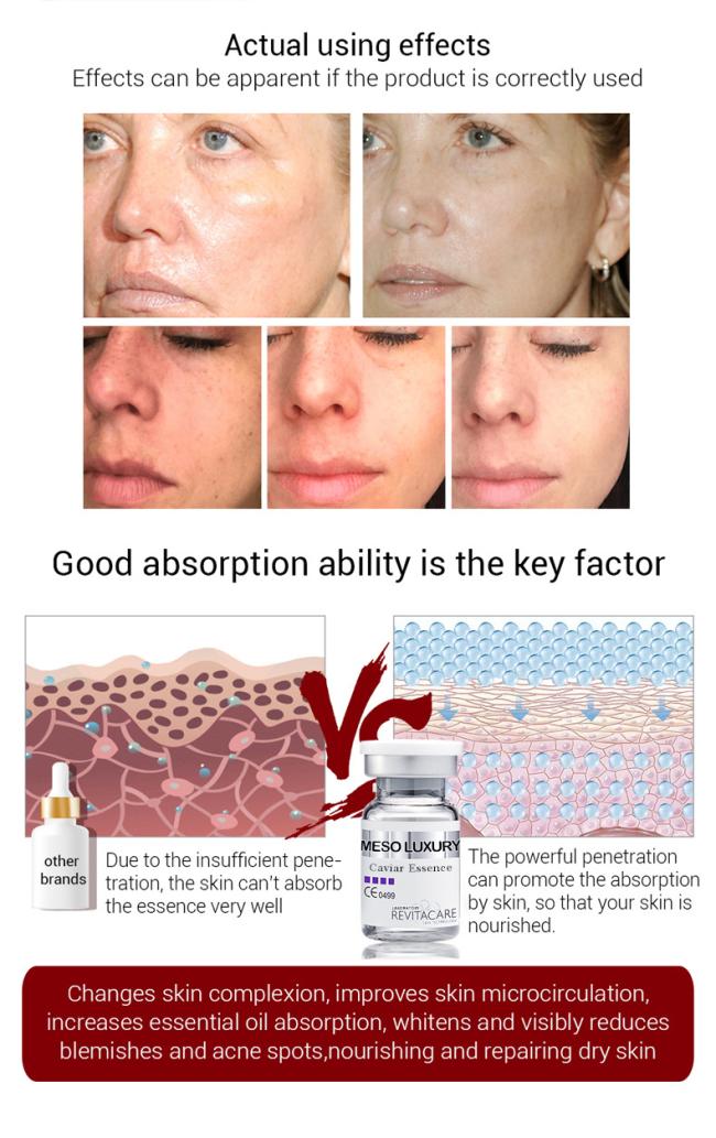 Face Care Kit Private Label Organic Caviar Essence Collagen Repair Anti Aging Serum Caviar Skin Care Set