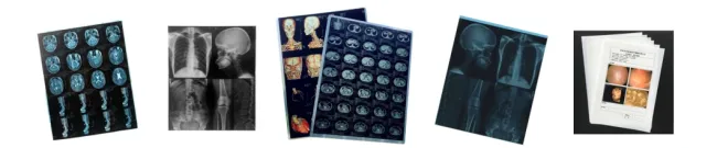 11X14 Inch Medical X-ray Film/Analogue Medical Film/Dry Film