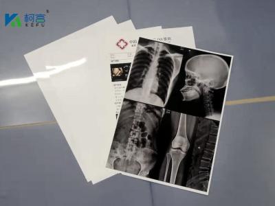 China 13X17'' White 180 Microns PET X Ray Film Sheets Transparency Film For Inkjet Printers à venda