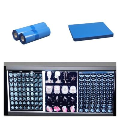 China Medical Inkjet X Ray Films For CT MRI DR CR Image Output Compatible With HP Printer for sale