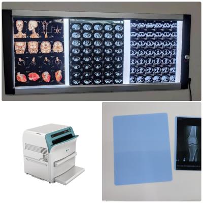 中国 ISO9001 CtスキャンX光線のフィルム14x17は医学のデジタルX光線のフィルムをじりじり動かす 販売のため