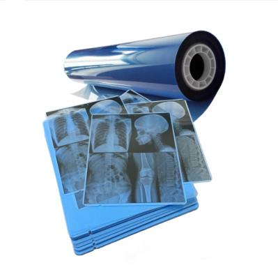 China Blue Medical Film Inkjet For Consistent X Ray Imaging Results for sale