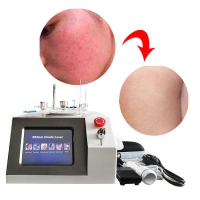 China 6 In 1 Spider Vein Laser Machine , 980nm Face Vascular Treatment Varicose Veins Machine for sale