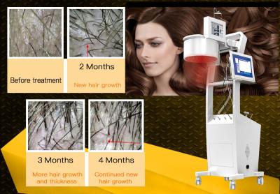 China equipamento do salão de beleza da rebrota do tratamento do escalpe da máquina do crescimento do cabelo do laser 650nm à venda