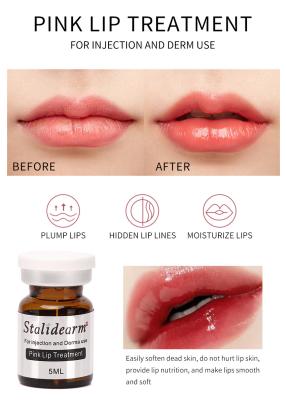 中国 卸し売りStalidearmの元のブランドのピンクの唇の処置の注入の血清の安全な本質のMeso療法は5pcs/Setを置いた 販売のため