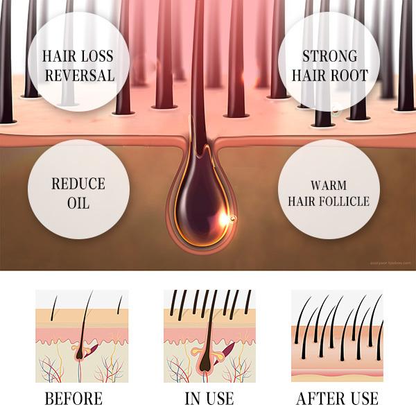 Hair Regrowth Machine side view displaying profile and dimensions