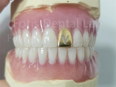 China Prótese dental acrílica con dientes naturales en venta