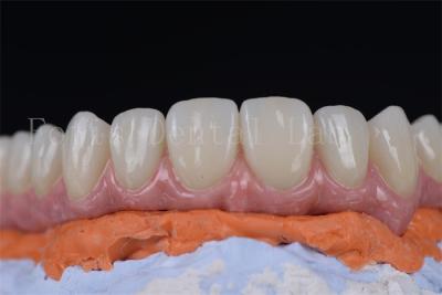 China Innovative Minimally Invasive All On 4 All On 6 Dental Implants In 1-2 Weeks for sale