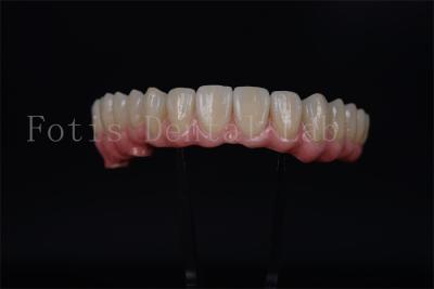 China Full Arch Implant Bridge All On 4 All On 6 For Complete Dental Restoration for sale