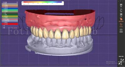 China Servicio de diseño dental con planificación de prótesis e implantes orales en venta