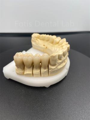 China Good Performance Dental Zirconia Multilayer The Ultimate Ceramic Solution for sale