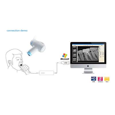 China Tratamiento dental portátil del PDA X Ray Machine Camera For Endodontic en venta