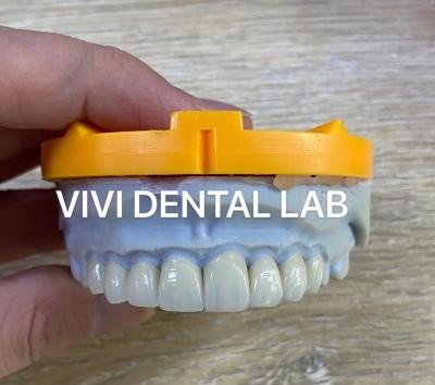 中国 Ivoclar Emaxの積層物は中国の半透明な専門の高レベル歯科実験室に張り合わせる 販売のため