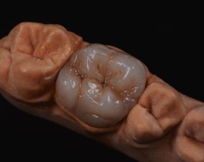 China 3D Pro Multi Layer Zirconia Dental Crown Bridge Full Anatomy for sale