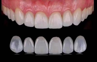Chine Les facettes dentaires laminées Emax transparentes / les facettes dentaires en porcelaine sont homologuées ISO à vendre
